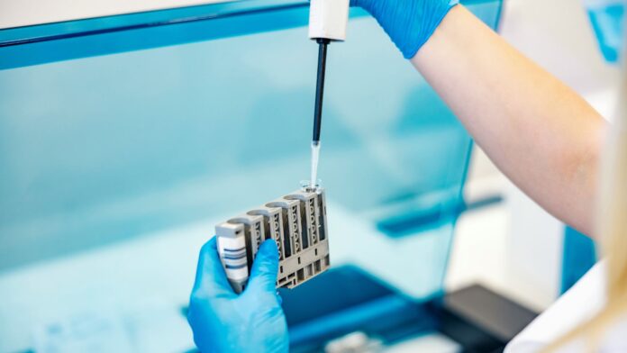 A Marietta laboratory owner is facing both criminal and civil action after Georgia Attorney General Chris Carr said his office uncovered alleged false genetic testing claims submitted to the Georgia Medicaid program.